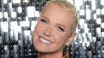 Xuxa fala sobre pouco cabelo e revela que tem alopecia androgenética