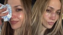 Jennifer Lopez sofre acidente em ensaio e leva pontos no rosto; veja