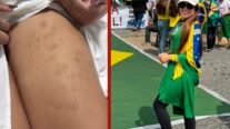 'Levei choque no peito e só tremia', relata empresária de Cuiabá atingida por raio antes de ato pró-Bolsonaro no DF