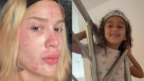 Karoline Lima mostra rosto após procedimento e filha pede maquiagem: “Fazer outra em você”